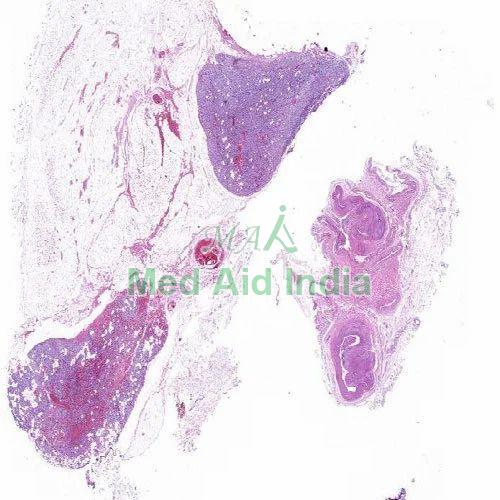 Plain Parathyroid Gland Histology Slide, for Clinical, Laboratory, Feature : Eco Friendly, Superior Quality