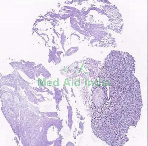 Plain Pituitary Gland Histology Slide, for Clinical, Laboratory, Feature : Eco Friendly, Superior Quality