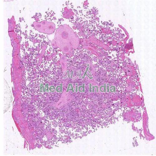 Transparent Rectangular Plain Placenta Microscope Slide, for Clinical, Laboratory, Size : Standard