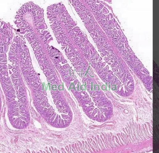 Transparent Rectangular Plain Small Intestine Histology Slide, for Clinical, Laboratory, Size : Standard