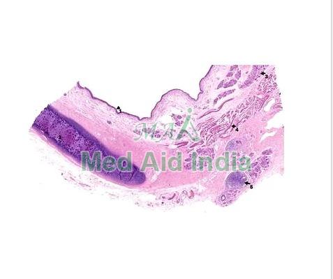 Transparent Rectangular Plain Trachea Anatomy Slide, for Clinical, Laboratory, Size : Standard