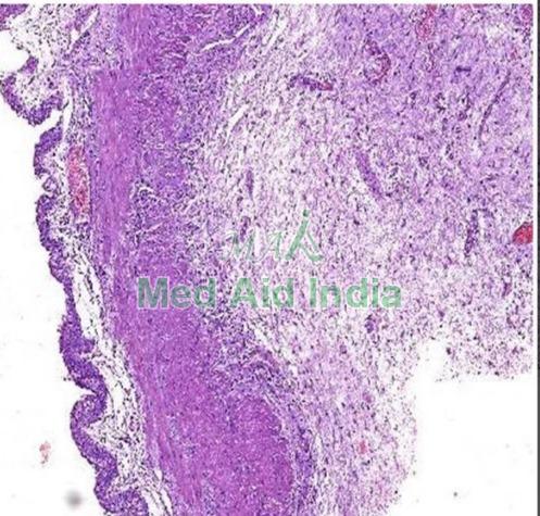Rectangular Plain Transitional Epithelium Histology Slide, for Clinical, Laboratory, Size : Standard