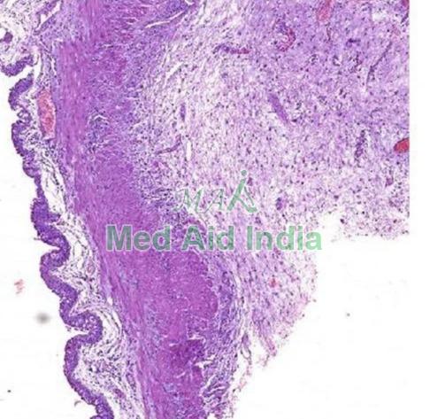 Transparent Rectangular Plain Urinary Bladder Histology Slide, for Clinical, Laboratory, Size : Standard