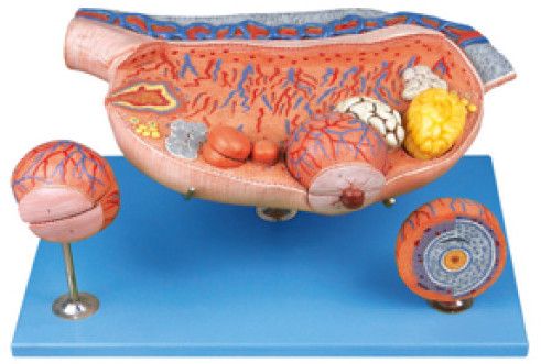 Gd a41003 Enlarged Ovary Model