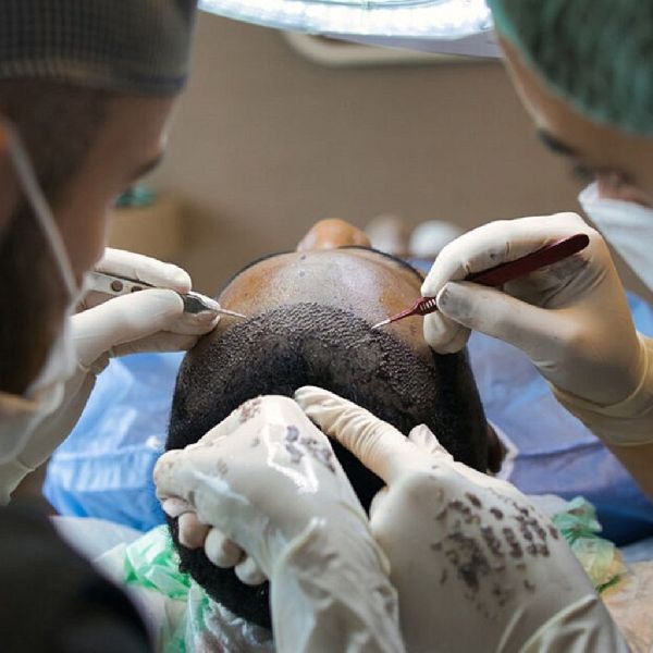 Hair Transplantation