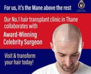 Hair transplant service