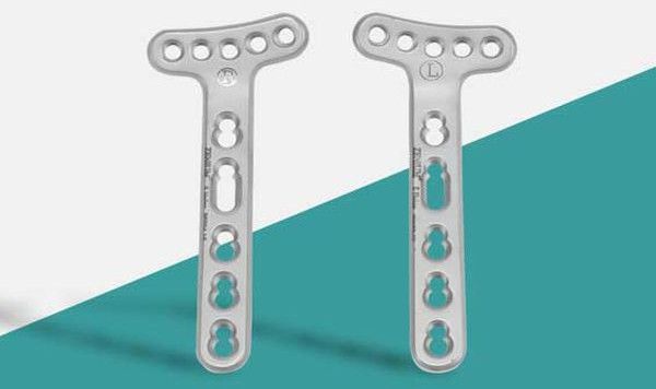 locking distal radius plate