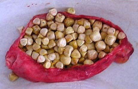 Ox Gallstones,cattle Gallstones,cow Gallstones