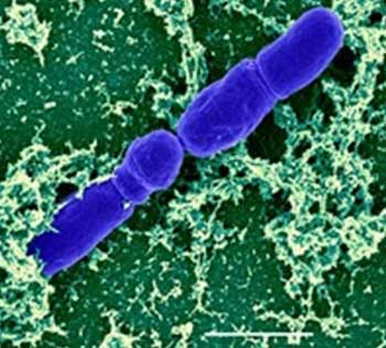 Bifidobacterium Infantis