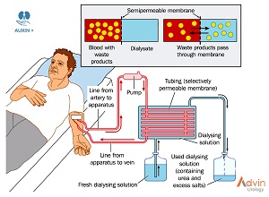 Auxin+ dialysis solutions
