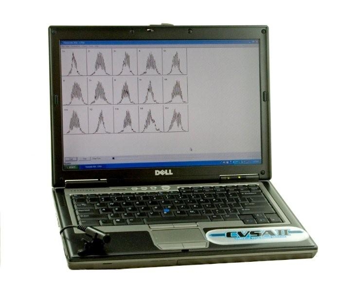 Stress analyzer