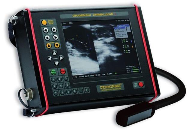 Echographe Ultrasound scanner