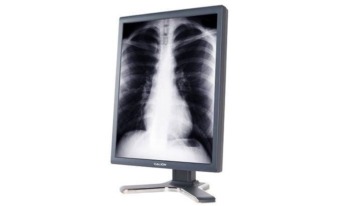 radiology monitors