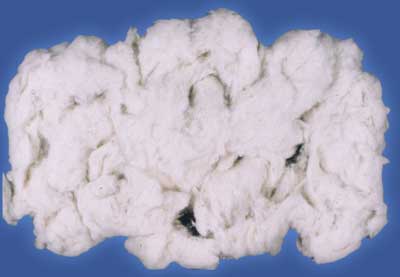 Cotton waste