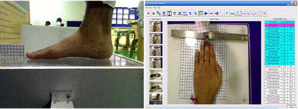 Anthropometric Analyser