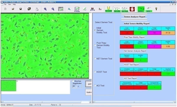 Semen Analyser