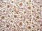 Cotton Upholstery Fabric, Width : 60 inches