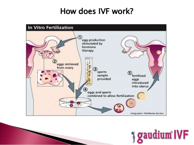 infertility treatment in Delhi