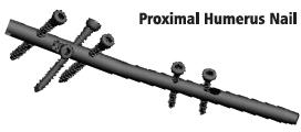 Proximal Humerus Intramedullary Nailing System