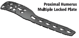 Proximal Upper Limb Plate