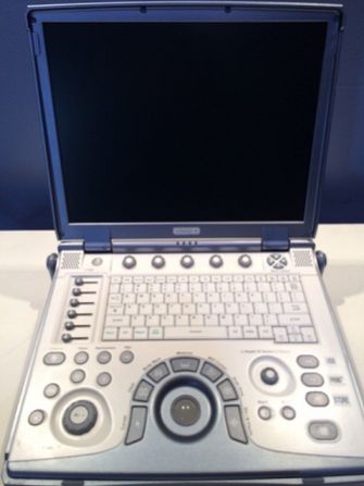 GE LOGIQ E portable ultrasound 3S-RS