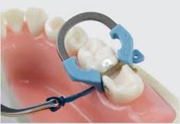 Dental matrix system