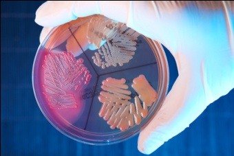 Microbiological Testing