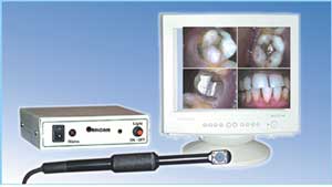 Intra Oral Camera