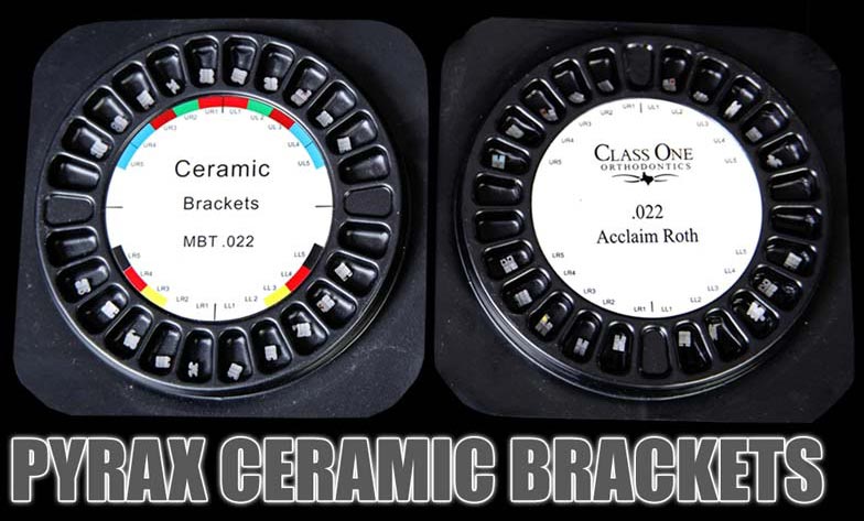 Ceramic Brackets