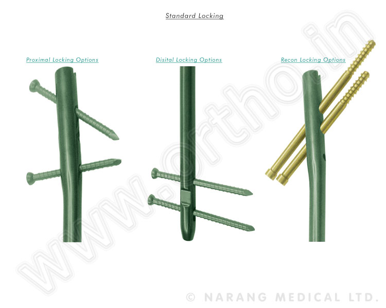 Perfect Femoral-Cannulated Long-Perfect Femoral Nails
