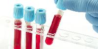 blood test equipment