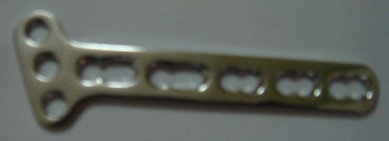 Lcp Locking Small Oblique Plate, for Hospital, Orthopaedi.