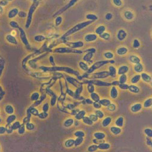 Entomopathogenic Fungus