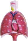 Lungs Models