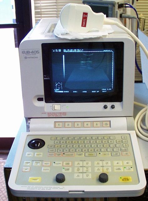 Hitachi EUB-405 Portable Ultrasound Scanner