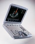 Sonosite Micromaxx Ultrasound System