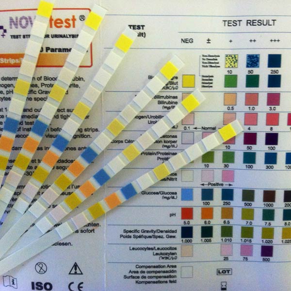 Urine Reagent Strips