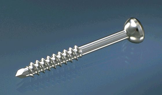 4.5 Malleolar Screw