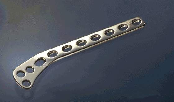 Lateral Tibial Head Buttress Plate  4.5 Mm Right Leg