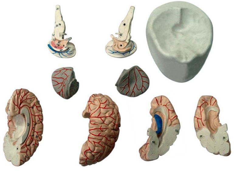 Human Brain with Arteries Model