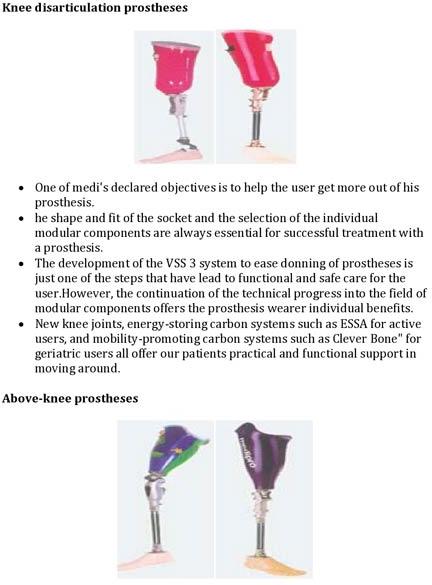 above knee prosthesis