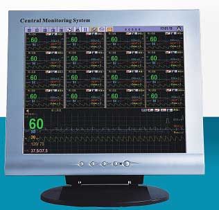 MM-C001 Central Patient Monitor System