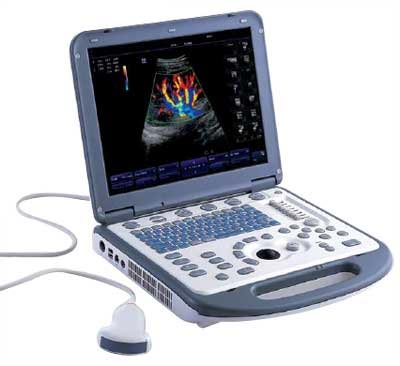 Portable Color Doppler Ultrasound System