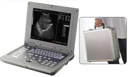 MM-US002 Notebook Ultrasound System