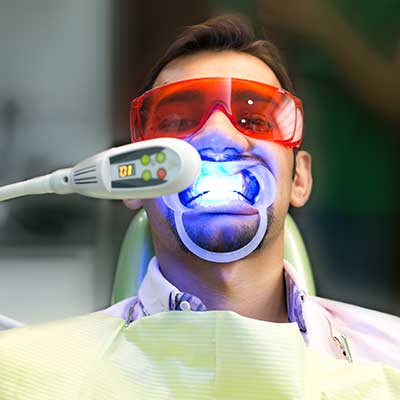 Teeth whitening service