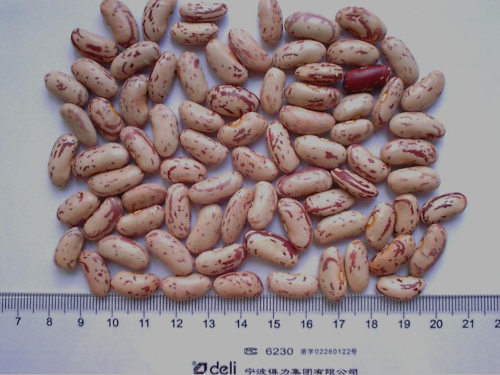 light speckled kidney beans