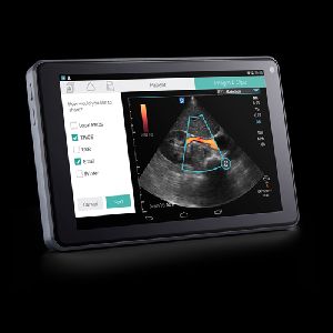 SonoSite iViz diagnostic tools