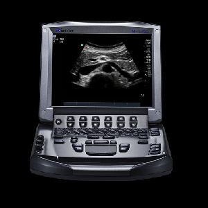 SonoSite M Turbo ultrasound system