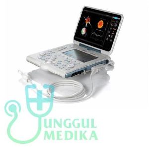 Esaote MyLab Alpha Portable Ultrasound