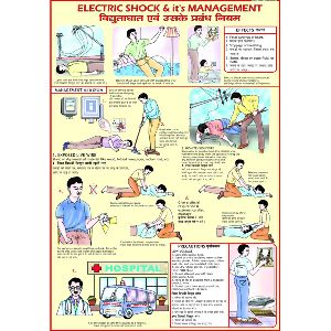 ELECTRIC SHOCK CHART